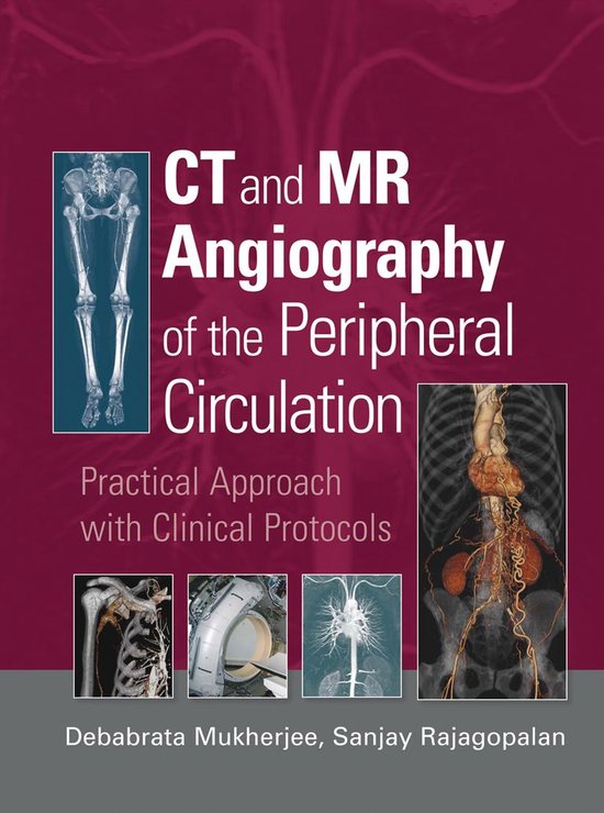 CT and MR Angiography of the Peripheral CirculationEbook Practical Approach with Clinical Protocols